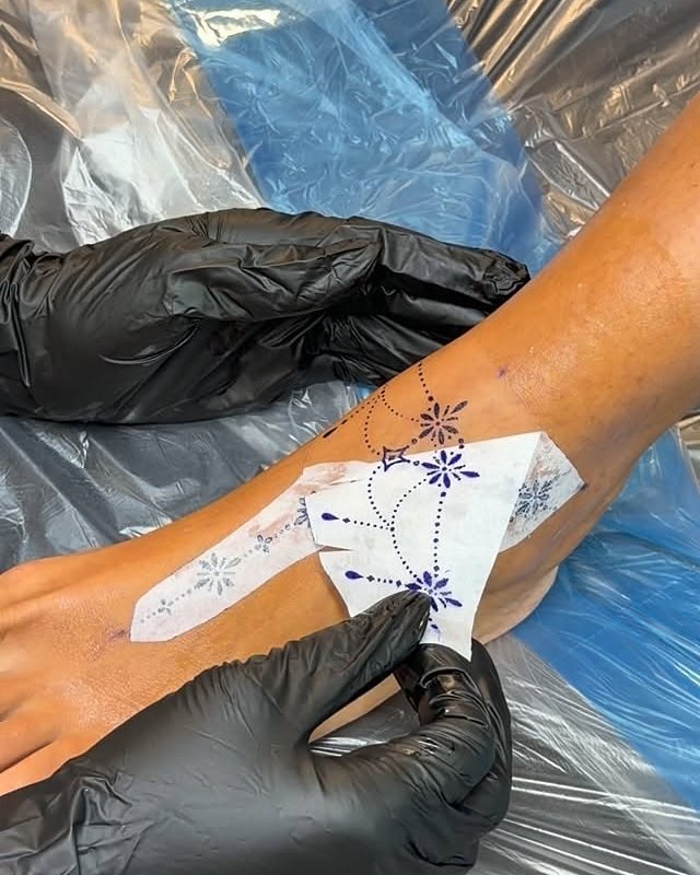 An ornamental stencil placed on a wrist before tattooing